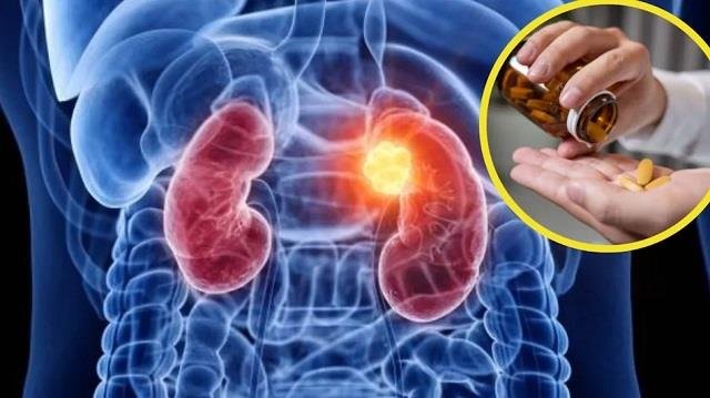 किडनी को हेल्दी रखने के लिए रोज़ाना खाएं ये 4 नेचुरल चीजें किडनी को हेल्दी रखने के लिए रोज़ाना खाएं ये 4 नेचुरल चीजें