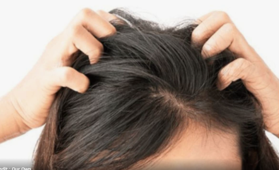 सिर की जूं ने, ले ली 12 साल की लक्ष्मीप्रिया की जान, बेटी ने इतना दर्द सहा कि कोई नहीं कर पाएगा यकीन सिर की जूं ने, ले ली 12 साल की लक्ष्मीप्रिया की जान, बेटी ने इतना दर्द सहा कि कोई नहीं कर पाएगा यकीन