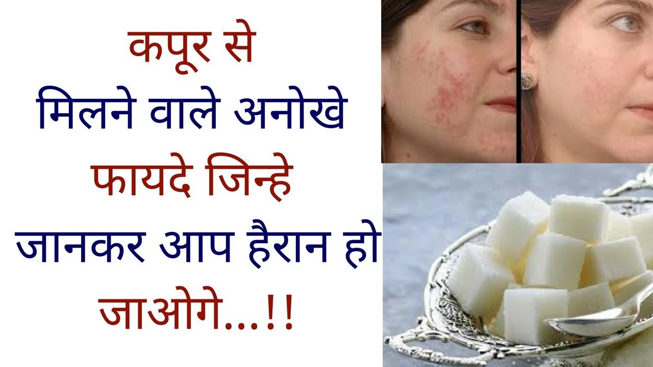 कपूर के ये चमत्कारी फायदे जानकर दंग रह जाएंगे! 90% लोग आज भी नहीं जानते इसका असली इस्तेमाल कपूर के ये चमत्कारी फायदे जानकर दंग रह जाएंगे! 90% लोग आज भी नहीं जानते इसका असली इस्तेमाल